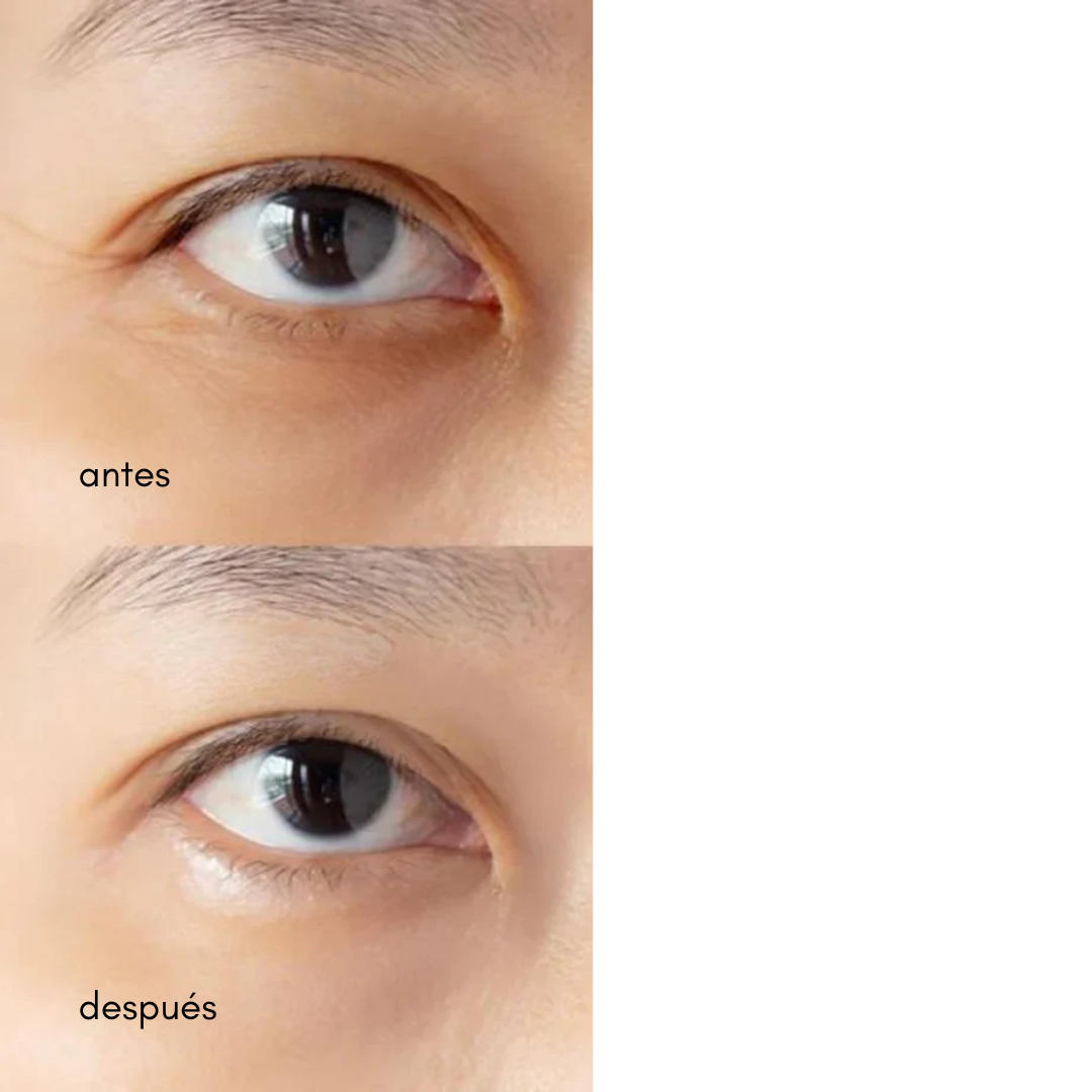 DR.ALTHEA To Be Youthful Eye Serum (Ilumina + Reafirma)